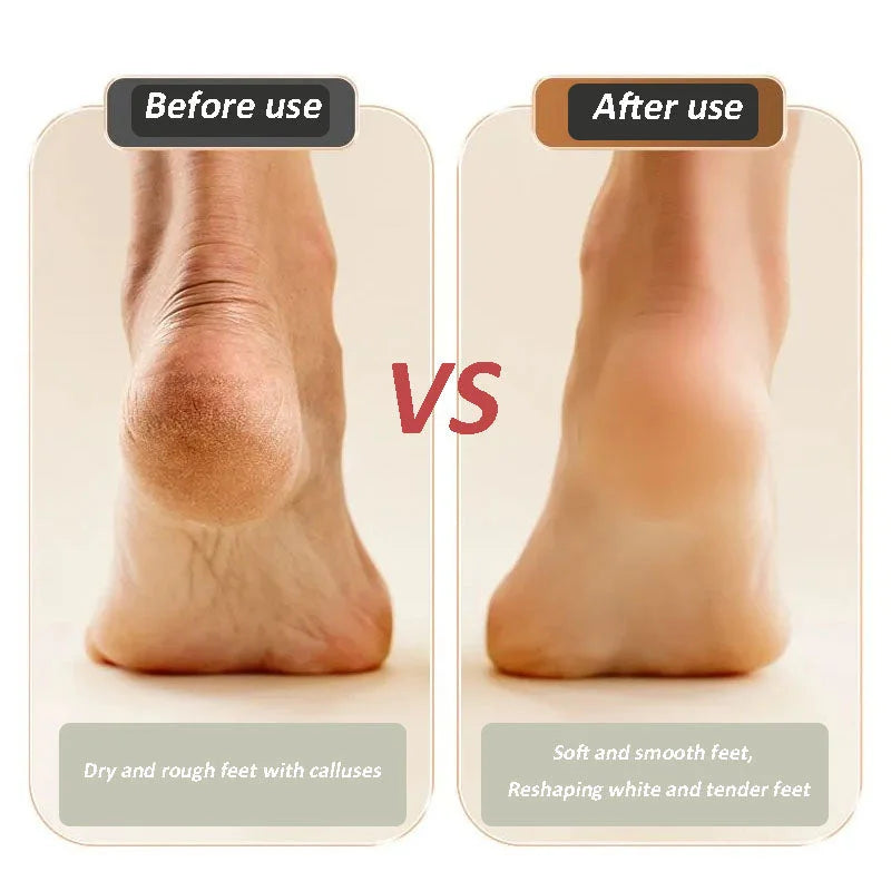 🔥Appareil de meulage des pieds rechargeable par USB 2025