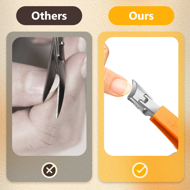 🔥50% de réduction🔥Ensemble de coupe-ongles anti-éclaboussures durable et pratique