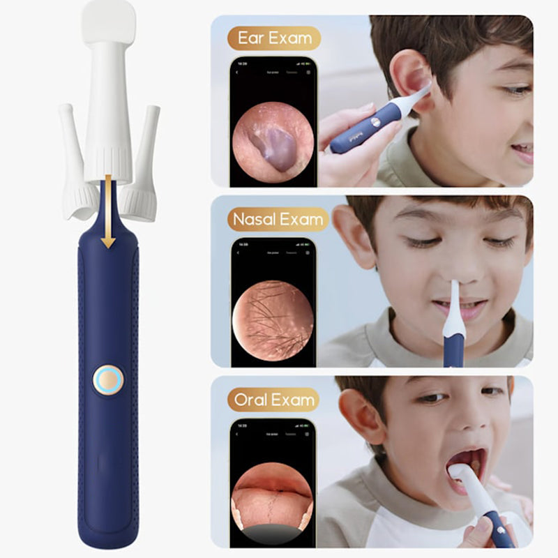 ⏳Spécial limité dans le temps🔥Kit d'élimination du cérumen Visual Curved(🔥50% de réduction)