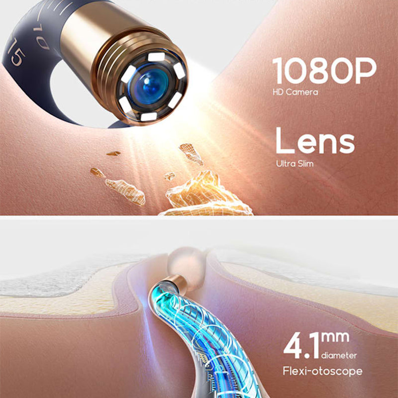⏳Spécial limité dans le temps🔥Kit d'élimination du cérumen Visual Curved(🔥50% de réduction)