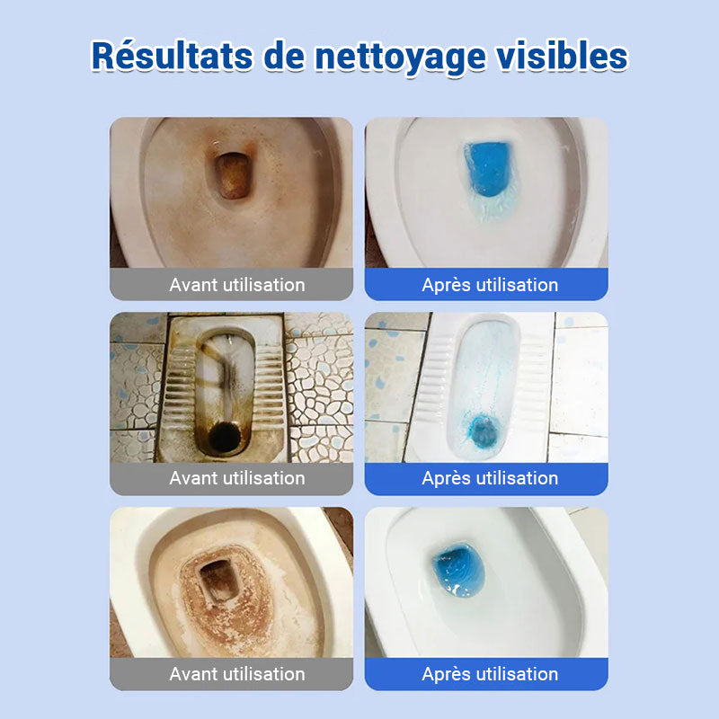 ✨Achetez plus, obtenez plus gratuitement✨🚽 Comprimés effervescents de nettoyage des toilettes - décontamination, tartre urinaire, alcali urinaire et élimination des odeurs