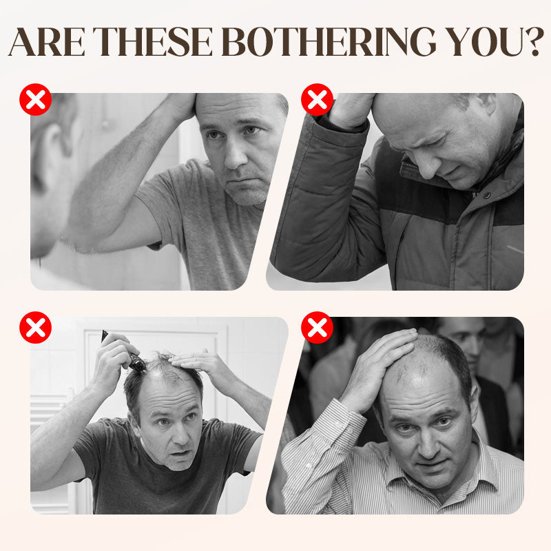 🧢 60 % DE RÉDUCTION ! 🎤 Perruque/chapeau hip-hop unisexe – Style grunge, doux et confortable, parfait pour les fêtes et les déguisements ✨