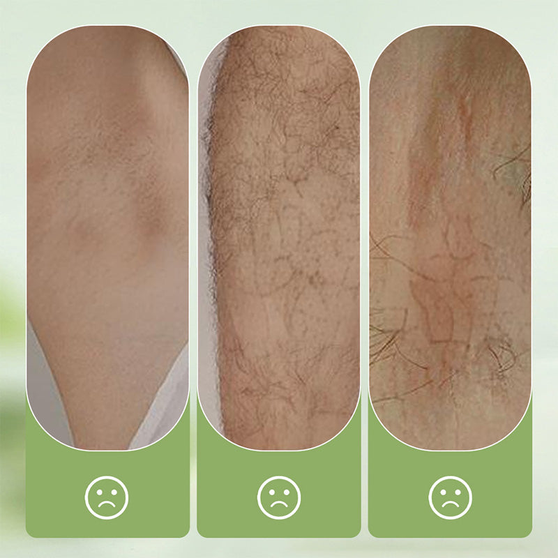 🧴 50 % DE RÉDUCTION ! 🪒 Kit doux et respectueux – Crème dépilatoire + rasoir – Sans douleur, pour les peaux sensibles, sans taches noires ni poils résiduels 🌸