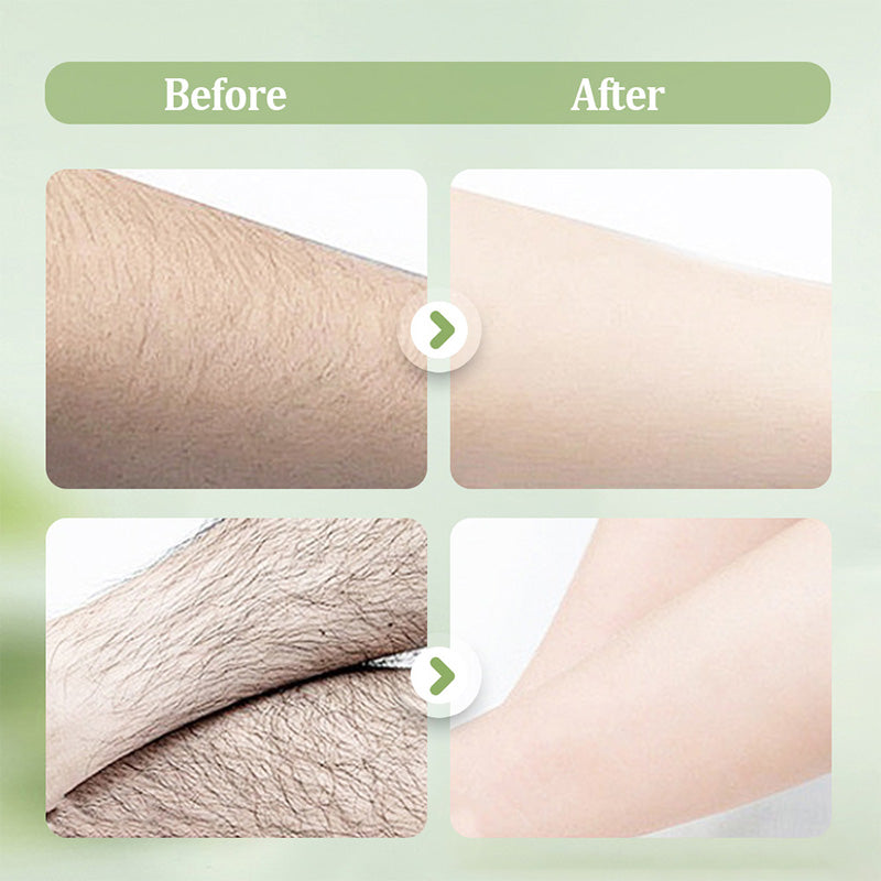 🧴 50 % DE RÉDUCTION ! 🪒 Kit doux et respectueux – Crème dépilatoire + rasoir – Sans douleur, pour les peaux sensibles, sans taches noires ni poils résiduels 🌸