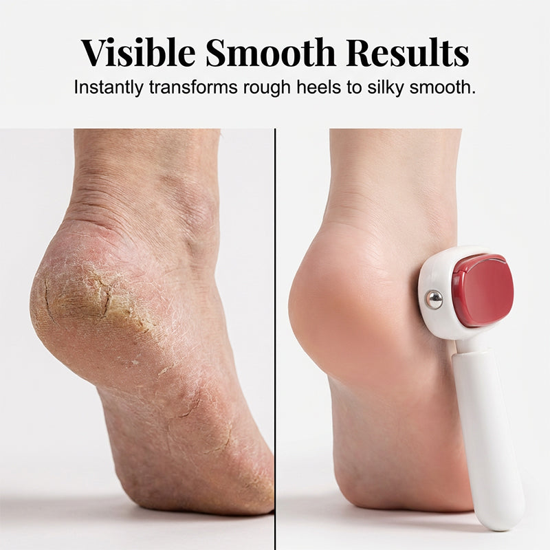 🦶 50% DE RÉDUCTION! ✨ Grattoir Pieds Double Face – Élimine les callosités, doux & facile à utiliser – Pieds lisses et adoucis en un clin d'œil 🏠
