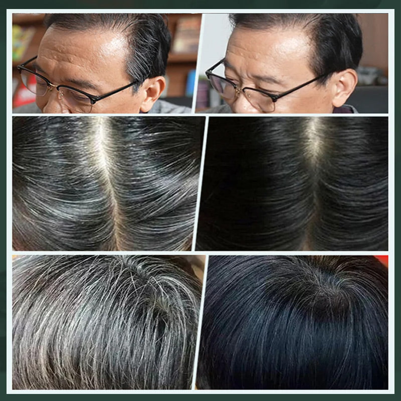 ✨ Coloration capillaire allemande à base de plantes pour des racines dignes d'un salon de coiffure – 100 % de puissance végétale, application facile et couverture des cheveux gris en 5 minutes 🌿